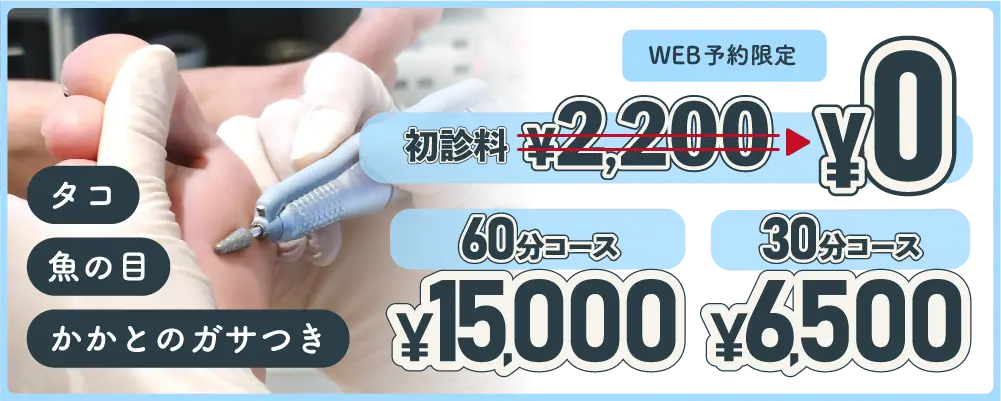 タコ・魚の目・かかとのガサつきなど 0円無料相談！